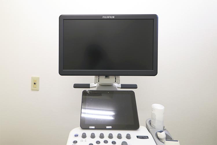 超音波診断装置